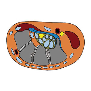 Karpálny tunel - prierez zápästia